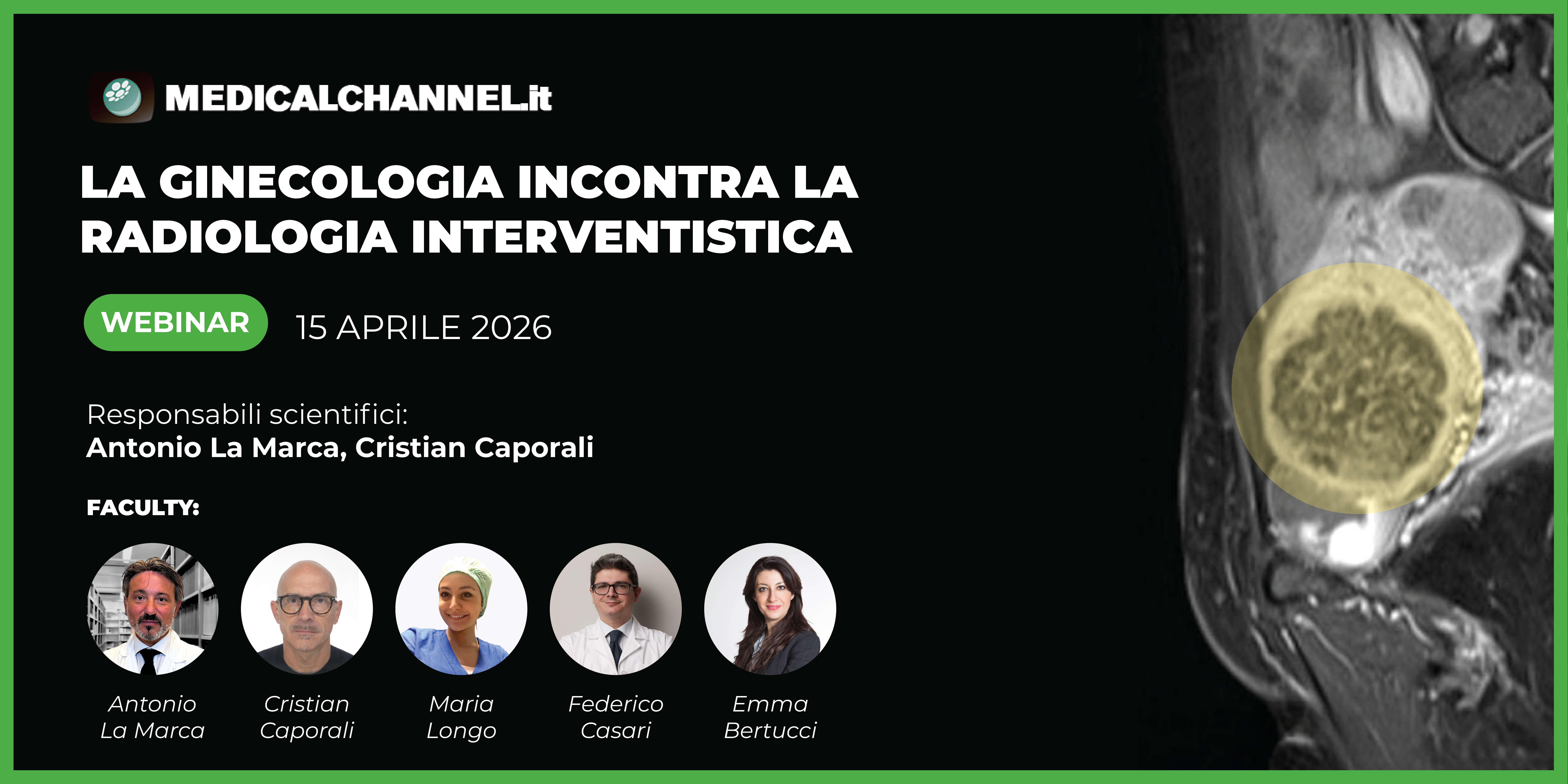 La ginecologia incontra la radiologia interventistica